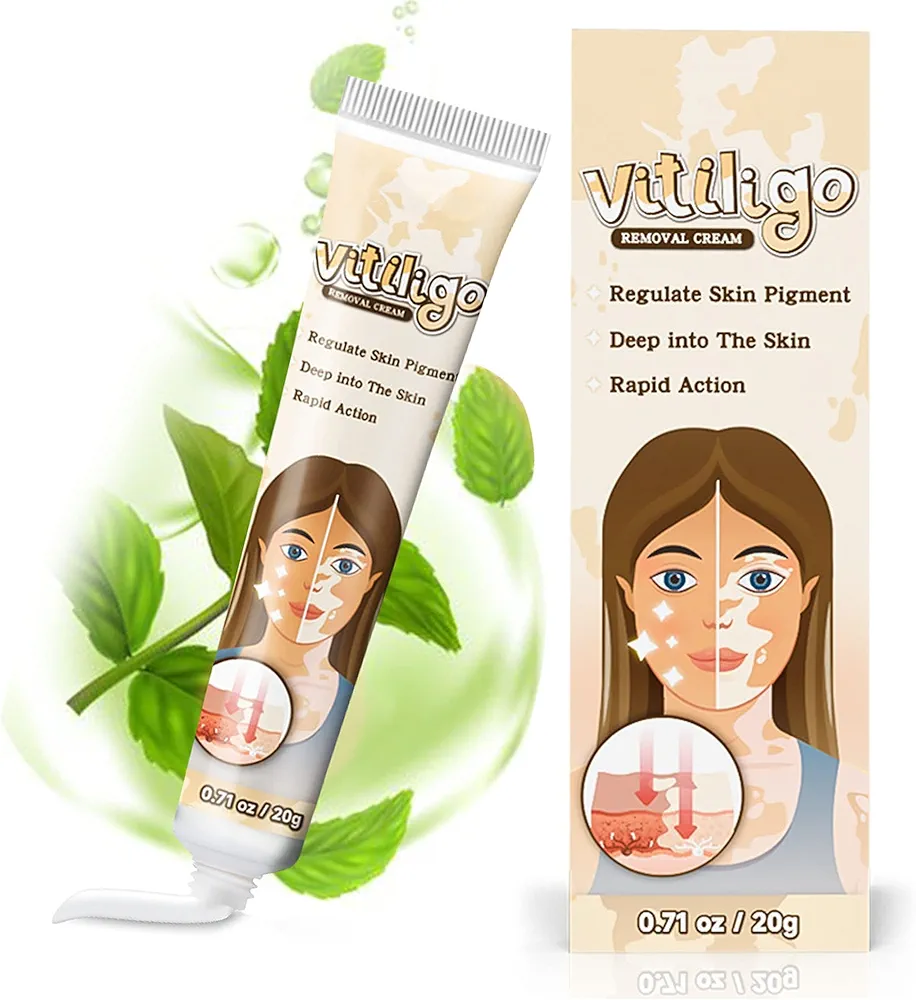 Vitiligo Treatment Cream, Natural Vitiligo Treatment for Skin Vitiligo,Improve Skin Pigmentation & Reduces White Spots, Suitable for All Skin