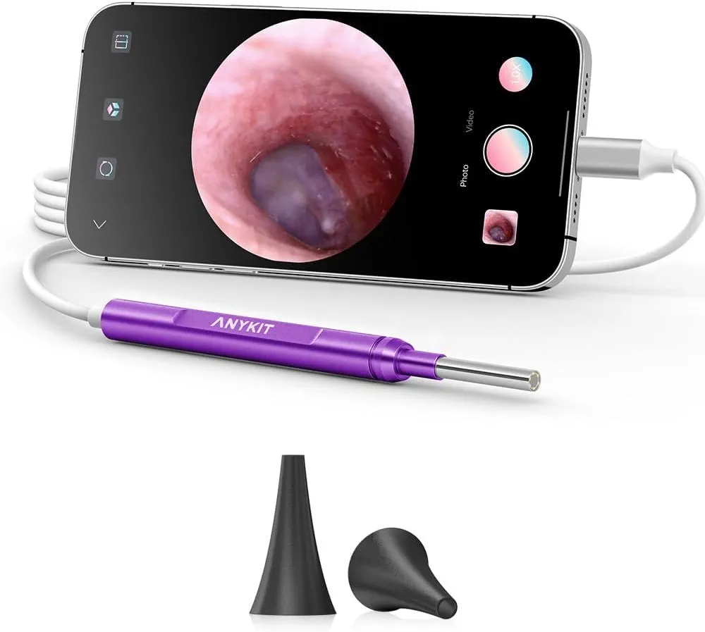 Anykit Digital Otoscope for Phone & Tablet, Ultra Clear View Ear Camera with Ear Wax Removal Tools, Video Ear Scope Otoscope with Light, Support Capture Photo & Record Videos