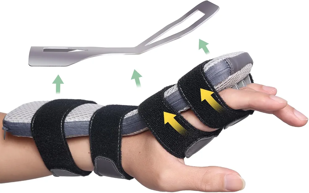 Radial Nerve Palsy Splint for Wrist Drop, Adjustable Static Fingers Fixation Brace, for Crutch Palsy, Limp Finger, Mcp Arthroplasty, Stroke Hand Recovery - Fits Right & Left Hand