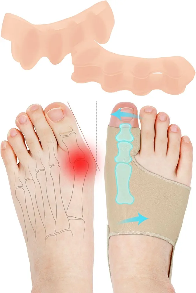 2 Pcs Toe Spacers and 2 Pcs Bunion Corrector