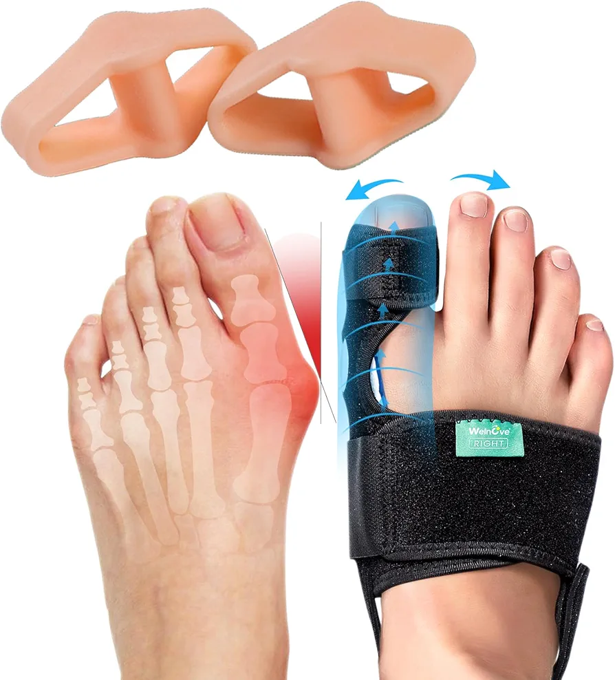 Welnove 12 Pack Bunion Corrector with 2 Loops and 1 Pair Bunion Splints with Soft Gel - Suitable for Bunion, Overlapping Toes - Big Toe Separators Spacers Bunion Braces