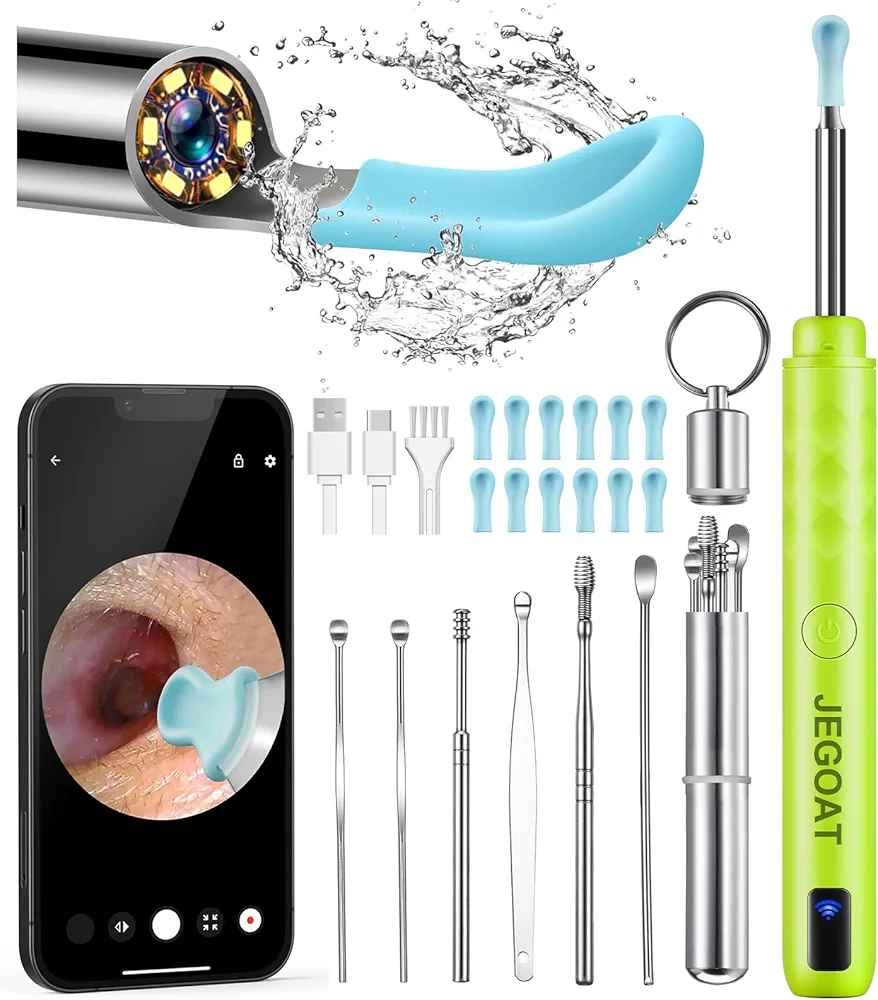 Ear Wax Removal Tool Camera, 1296P HD Scope and 6 LED Lights, Ear Cleaner Kit, Earwax Removal with Camera - Earwax Remover Tool with 12 Spoon