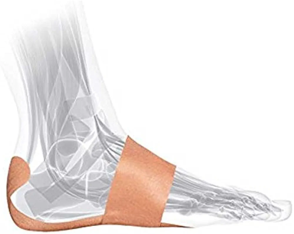 System for Plantar Fasciitis